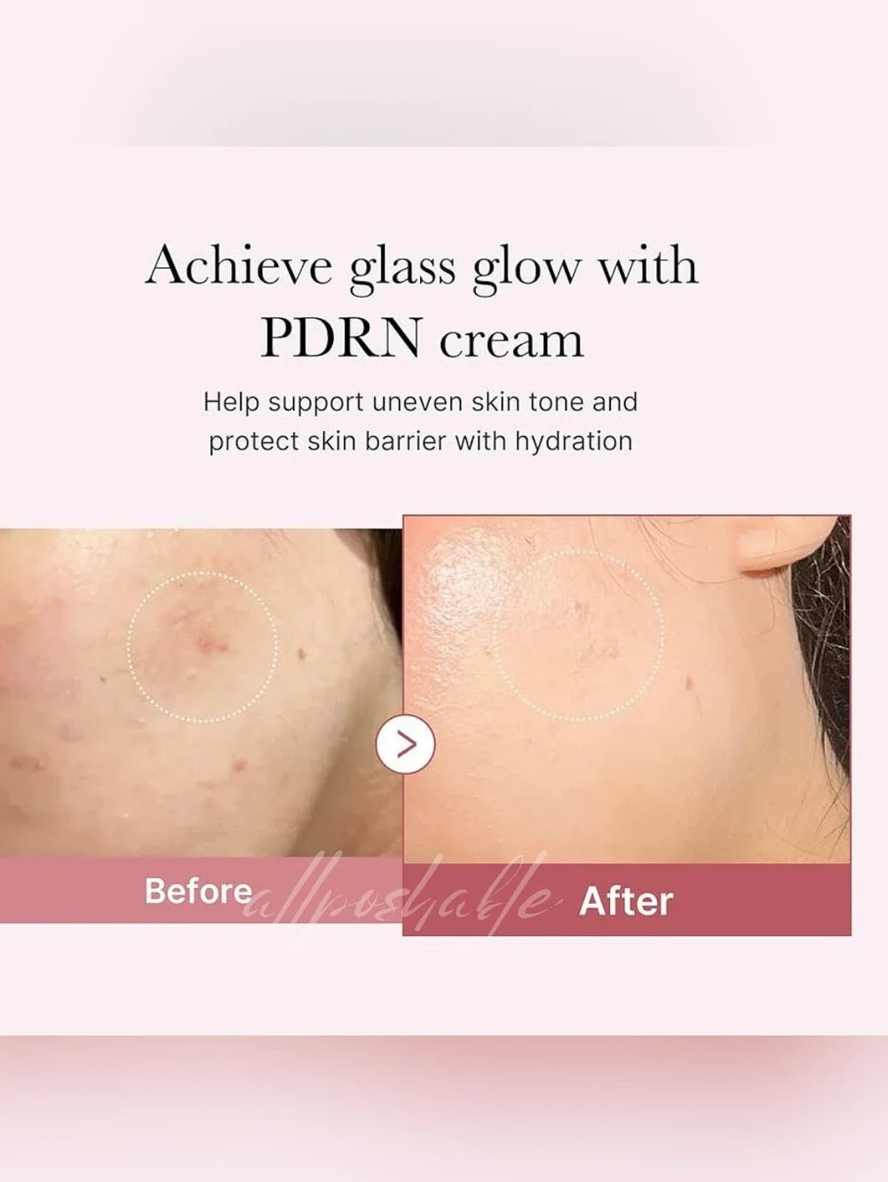 ⭐️LTD QTY⭐️ Medicube PDRN Pink Hyaluronic Moisturizing Cream